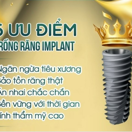 Trồng implatn chất lượng cao  giá ưu đãi 