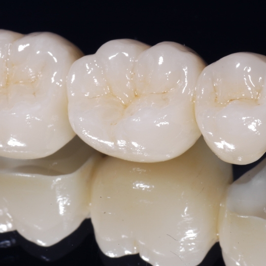 Răng sứ Nacera Q3